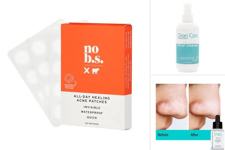 Detailed view of Best Healing Acne Solutions