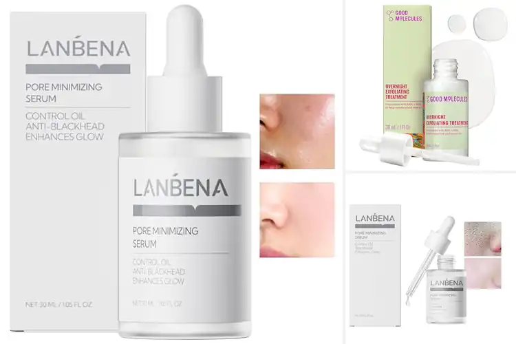 Detailed view of Best Pore Minimizing Treatments